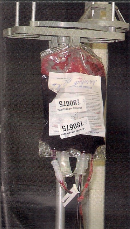 Донору плазмы возвращают эритроциты Донору плазмы возвращают эритроциты